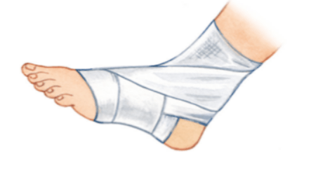 Решение рисунок 1